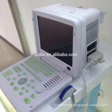 portable medical ultrasound diagnostic equipment & ultrasound body scanner & ultrasound with pesudo color DW360